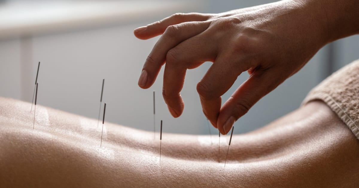 Acupuncture and CBT Are Effective Treatments for Insomnia