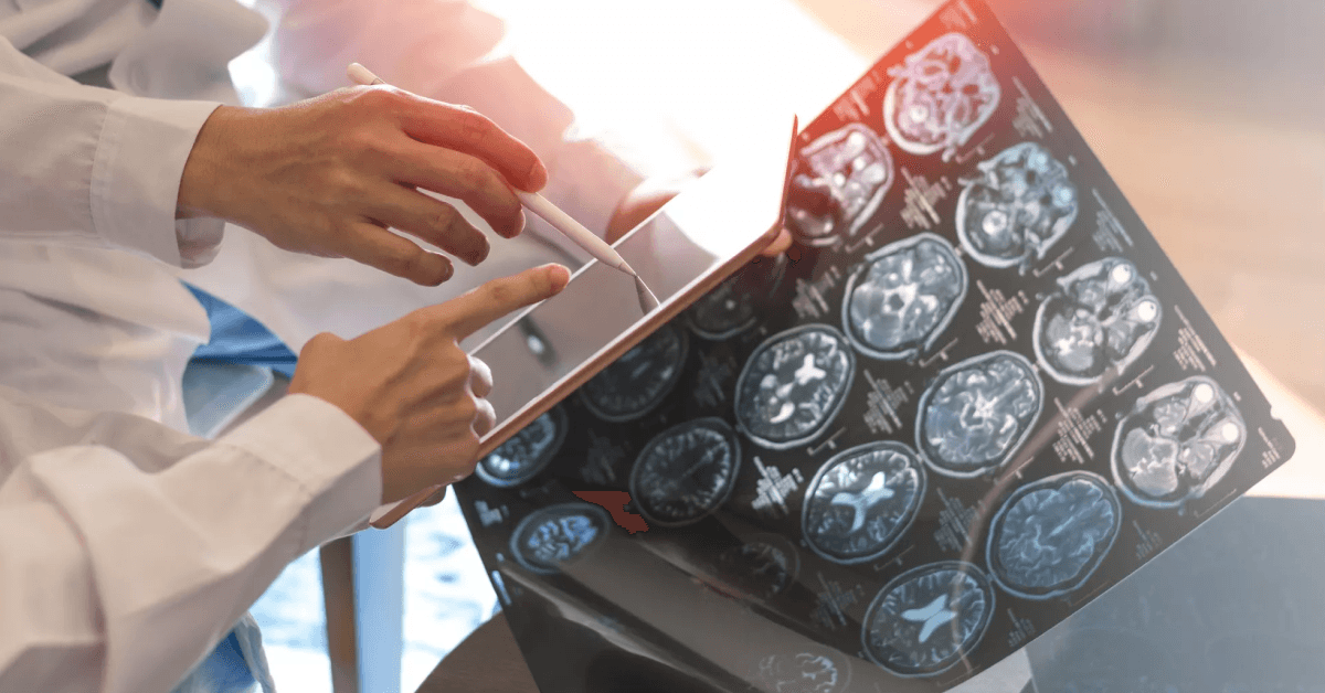 researchers using scans and AI to assist diagnosis