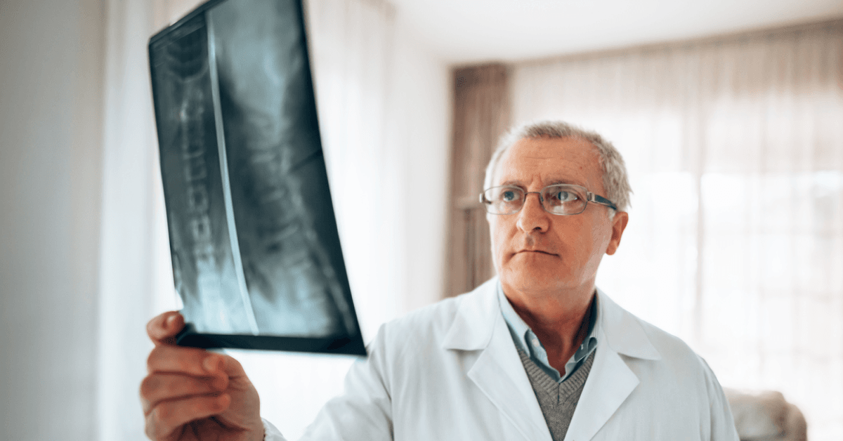 mesothelioma doctor reviewing scans of patient