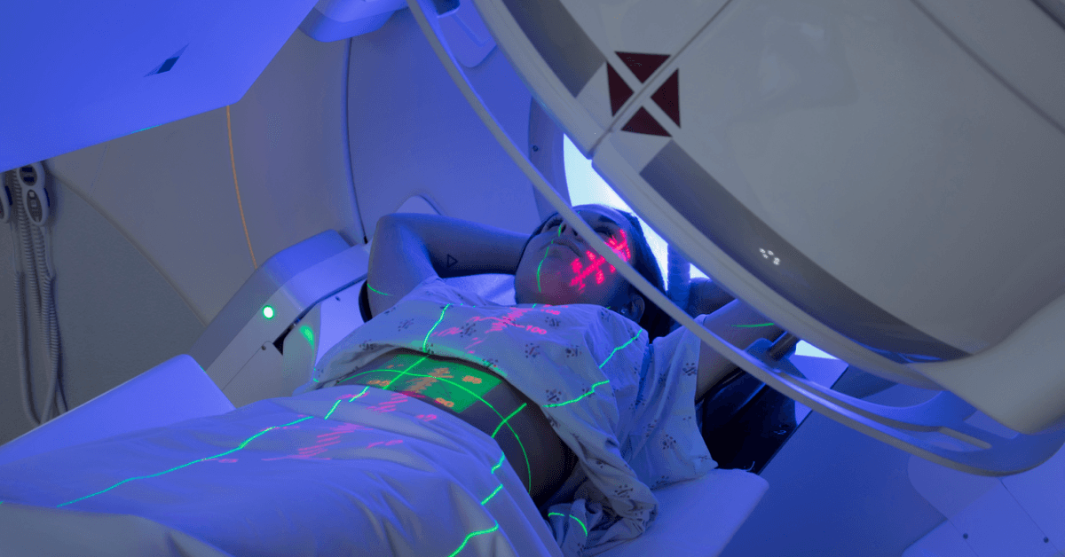 advanced radiotherapy