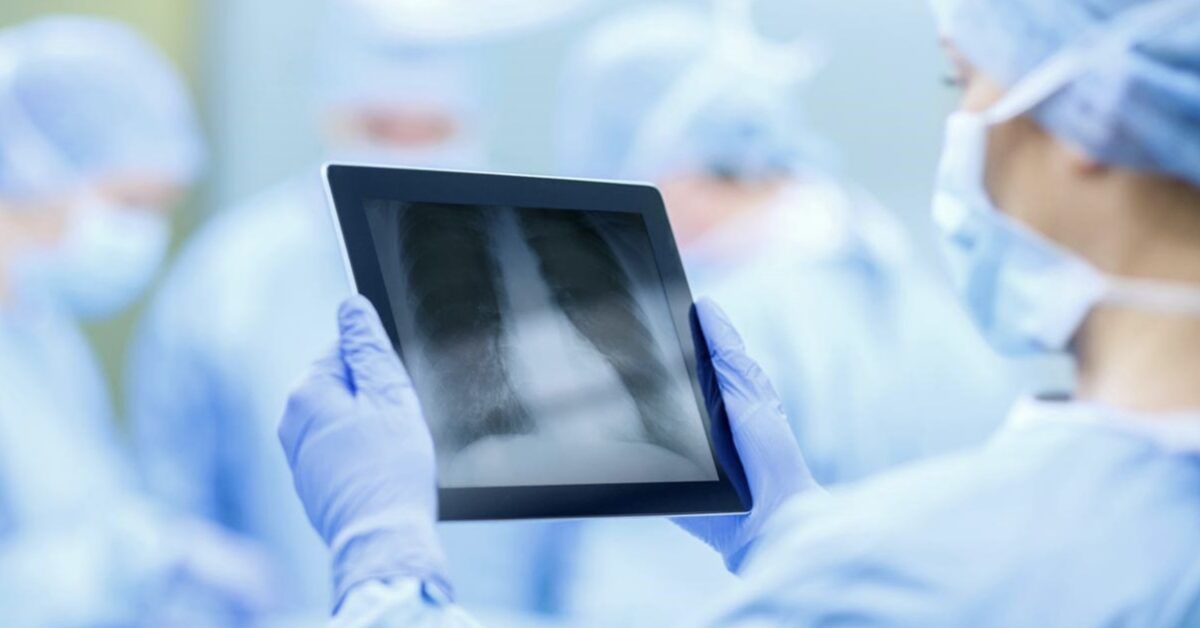 Surgeon Examining X-ray On Tablet Computer In Operating Room of mesothelioma patients lung