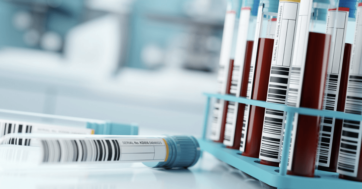 Blood Test Results In A Medical Lab